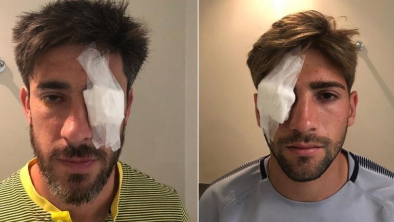 Los médicos evaluaron a los jugadores de Boca heridos pero no consideraron las lesiones en los ojos