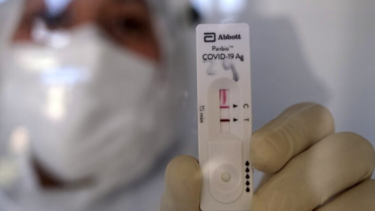 Llegaron al país 2,2 millones de test para la detección rápida de coronavirus